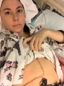 Alexa after surgery.