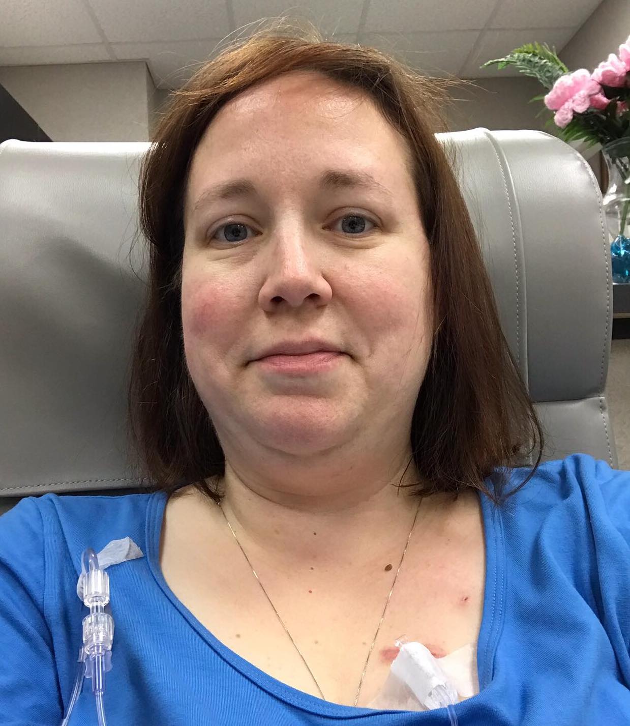 Heather Tucker chemo radiation chemotherapy